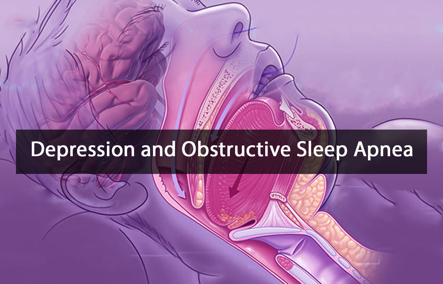 Depression And Obstructive Sleep Apnea Clinical Implications