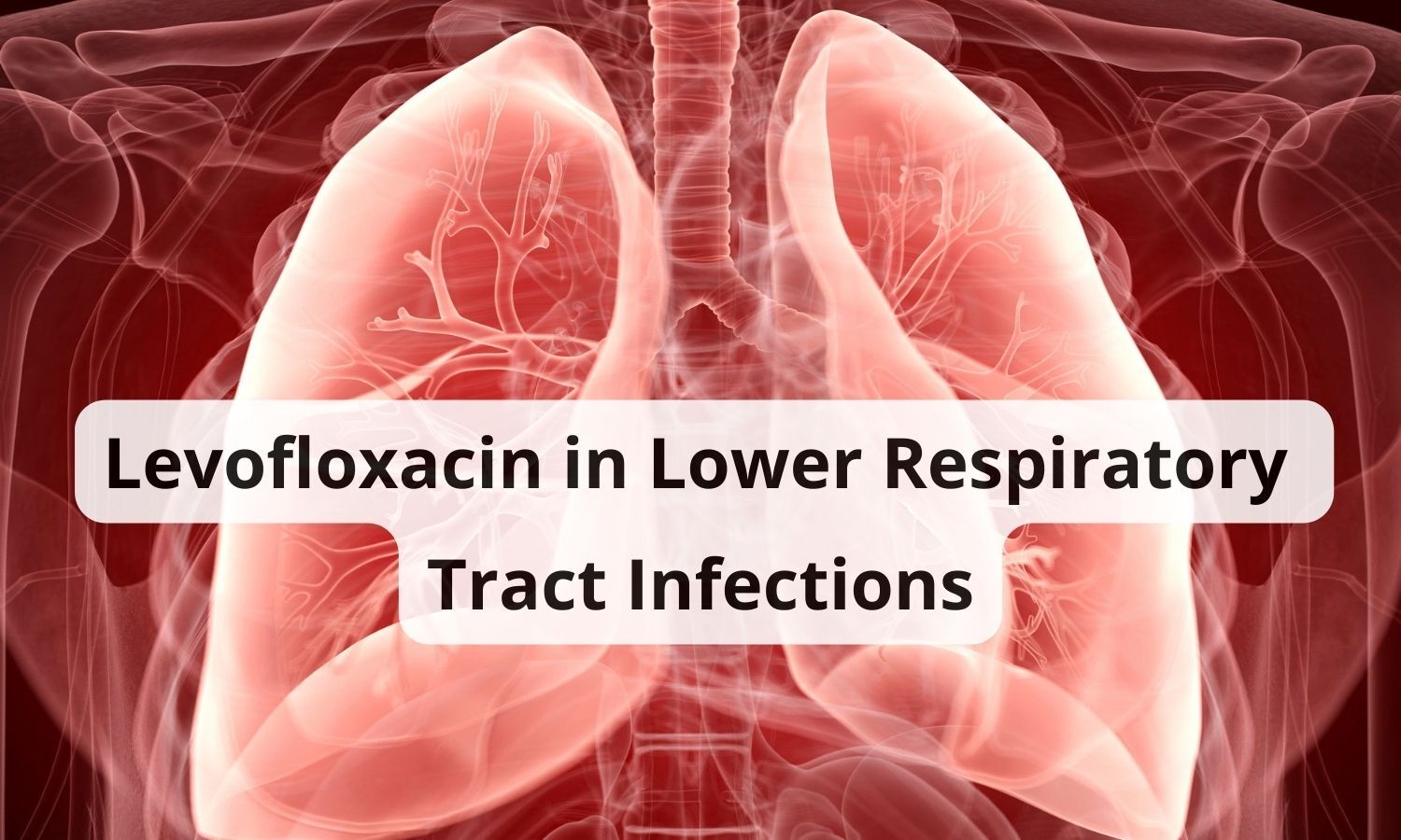 Understanding The Scope Of Levofloxacin In Lower Respiratory Tract