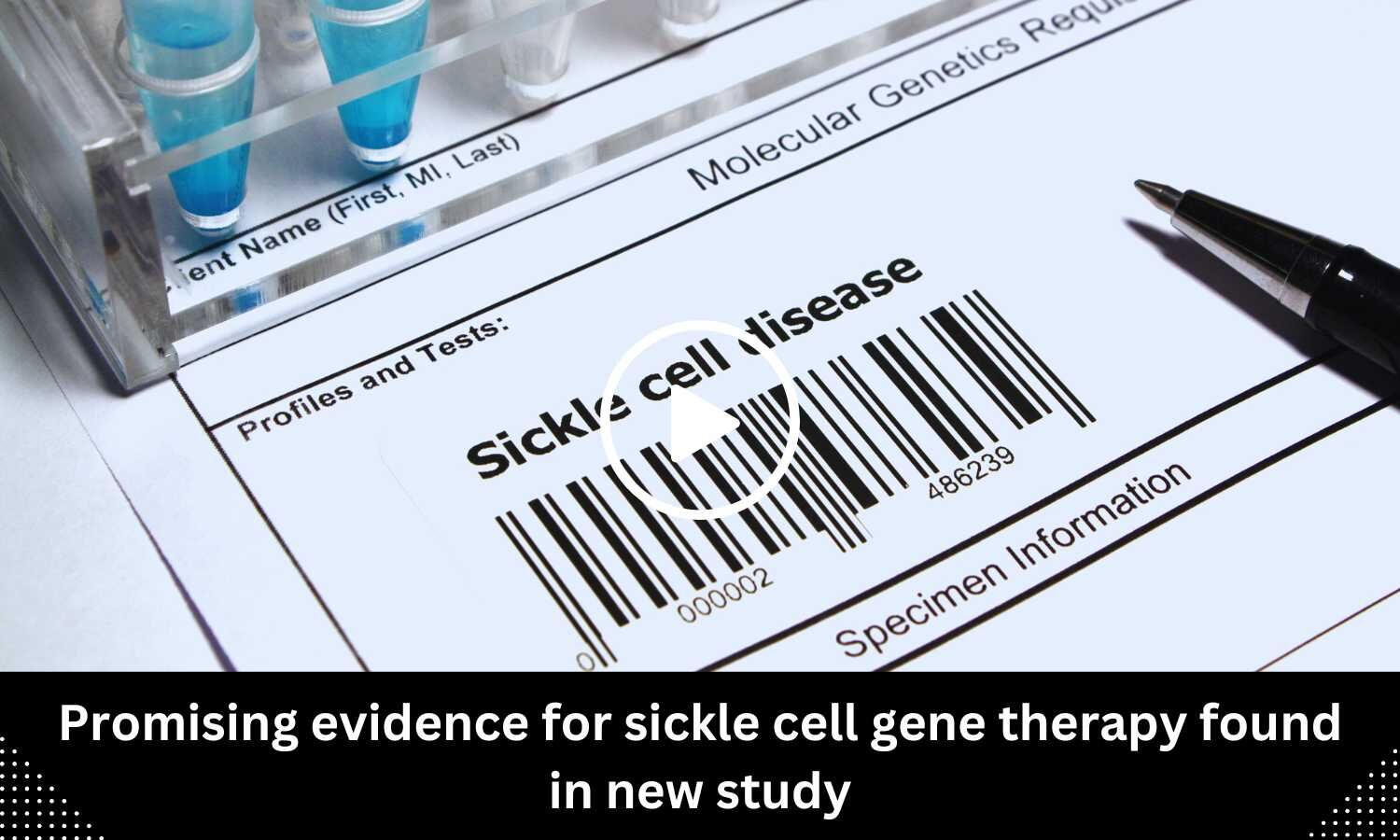 Promising Evidence For Sickle Cell Gene Therapy Found In New Study