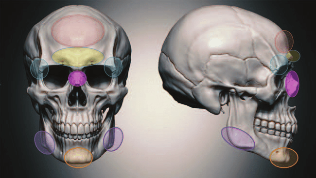 CT plays significant role in planning Facial Feminization surgery