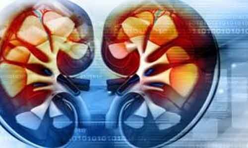 Bicarbonate pre hydration before contrast CT may not confer renal safety in CKD: JAMA