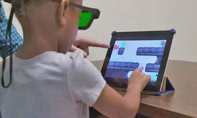 Binocular treatment in children with Amblyopia shows little promise; finds study