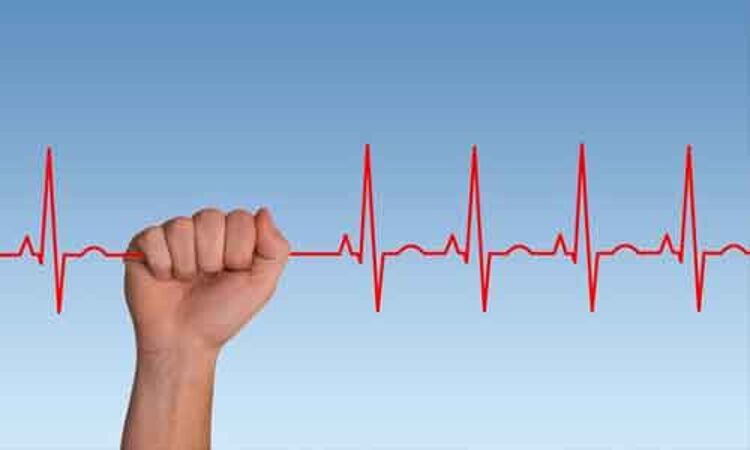 Inverted T wave during AF rhythm associated with CV events: Study