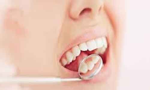 Intra oral scanner effective for non-invasive assessment of gingival inflammation