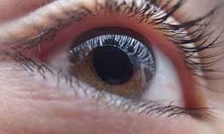 Ocular hypertension in glaucoma patients is related to higher central corneal thickness: Study