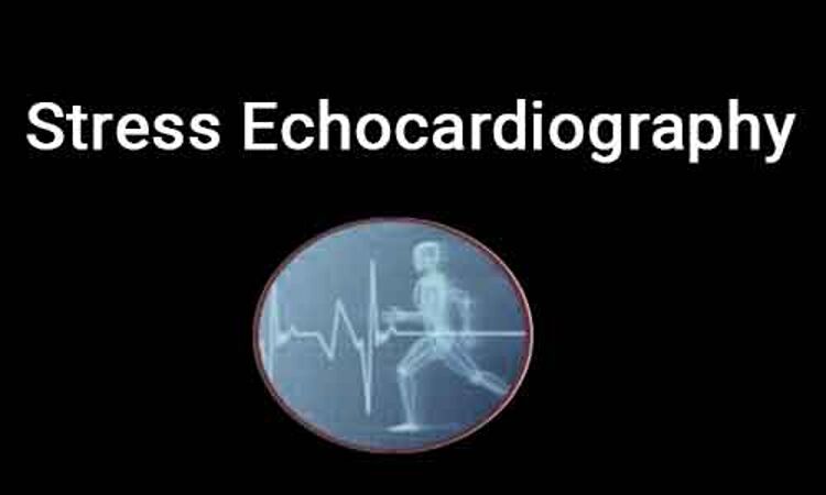 Stress echocardiography- ASE guidelines