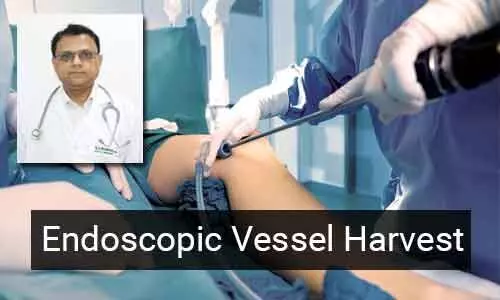 Understanding Endoscopic Vessel Harvest - A Minimally  Invasive approach for conduit harvesting during CABG