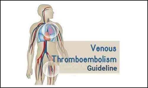 Perioperative Venous Thromboembolism Prophylaxis European Guidelines