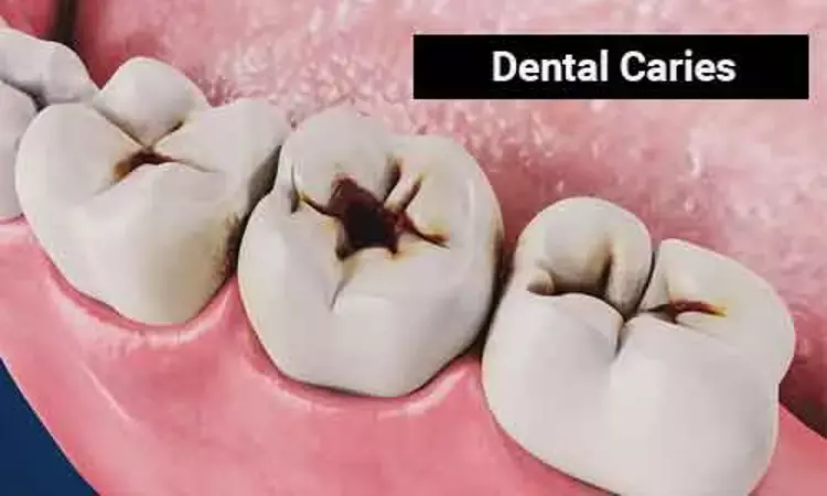 Behavioural factors, anthropometric factors linked to dental caries: Study