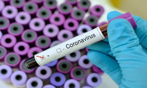 Two new rapid tests that could help contain Coronavirus epidemic
