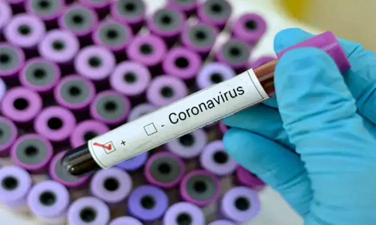 WHO interim guidance on laboratory testing for coronavirus