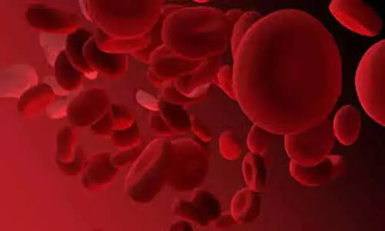 Transfusion support in sickle cell disease: ASH 2020 guidelines
