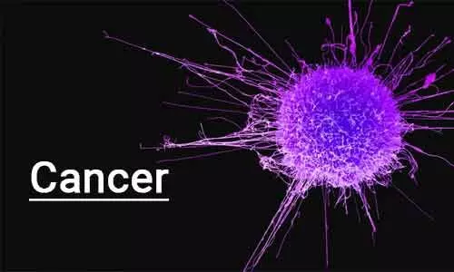 New biomarkers developed for detection of  urological cancers