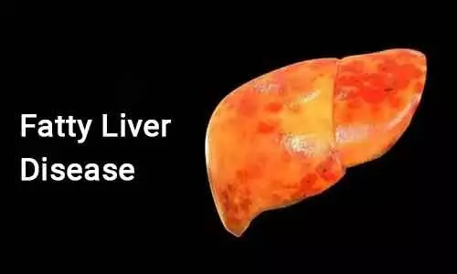 Eating less improves prognosis of liver cancer due to fatty liver