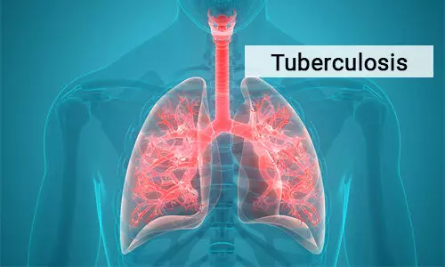 Researchers develop non invasive sticker patch for faster diagnosis of tuberculosis