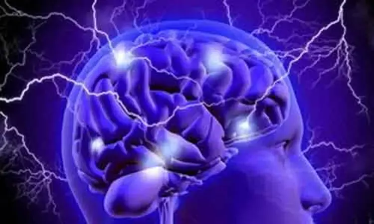 Post stroke seizures linked to increased death and disability
