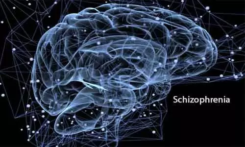 New analysis method of functional MRI may improve schizophrenia treatment