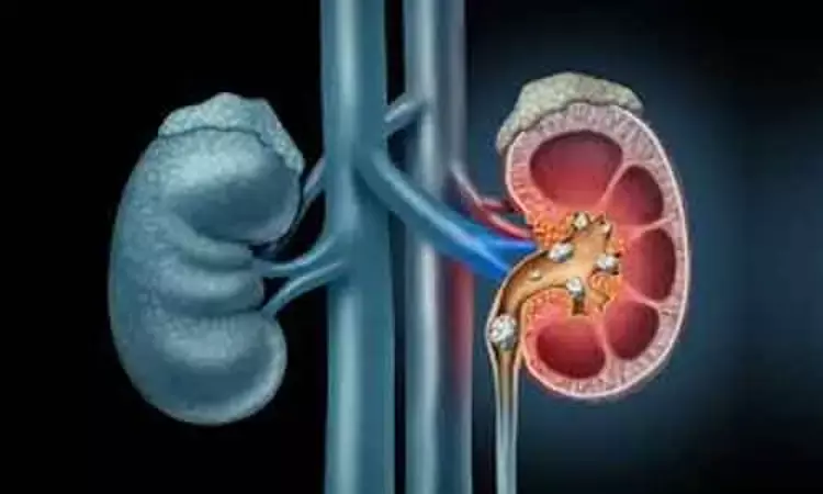 Early surgery reduces narcotic requirement in patients with kidney stones: Study