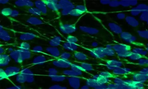 New Imaging technique effectively measures mitochondrial dysfunction in motor neuron disease