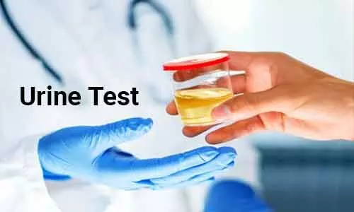 Urine test in COVID-19 patients predicts kidney injury, death: Study