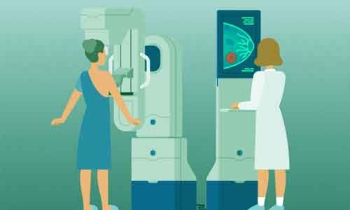 Study shows low rates of breast cancer overdiagnosis in mammography