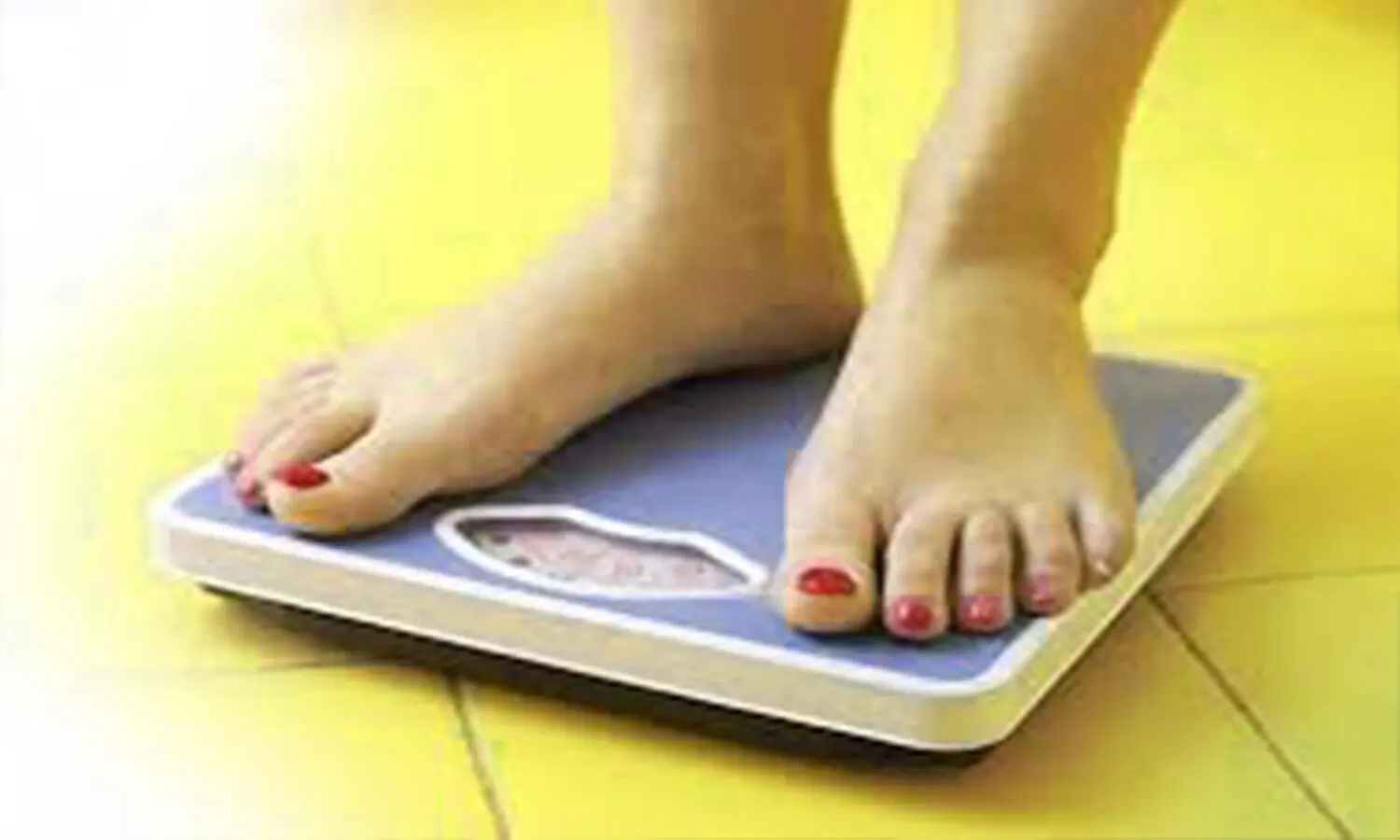Diet and exercise reduced weight and knee pain in obese osteoarthritis patients: JAMA