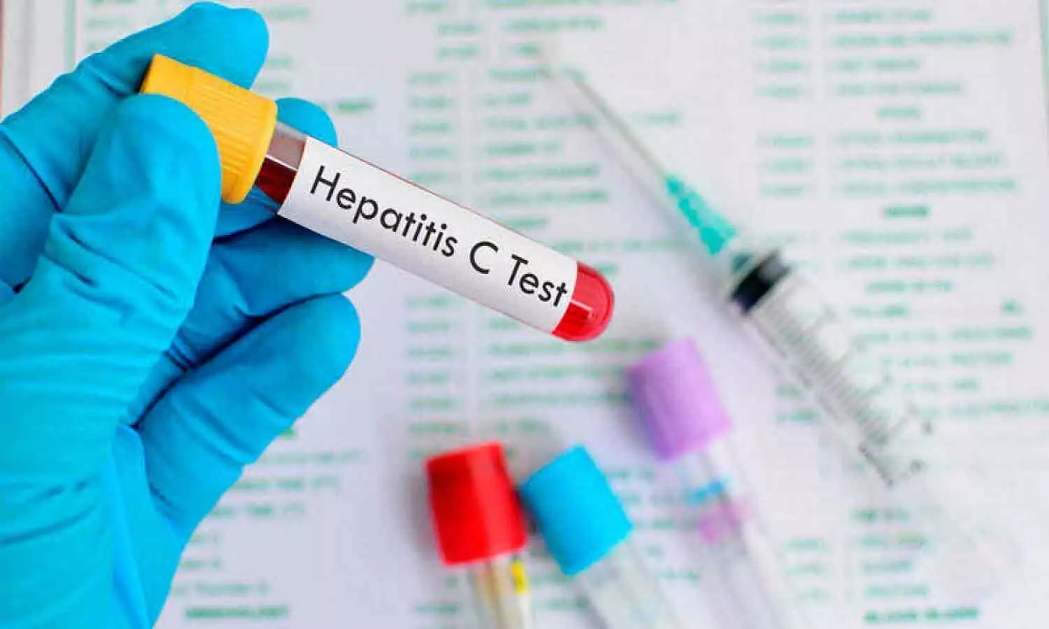 Antiviral treatment for hepatitis C reduces risk of post-treatment liver cancer progression, study shows
