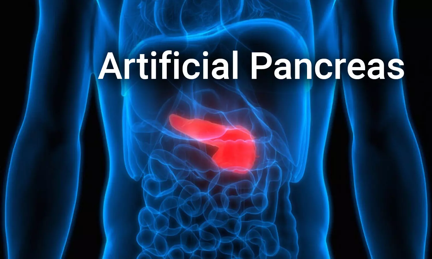 For the first time, researchers trial artificial pancreas on outpatients with type 2 diabetes