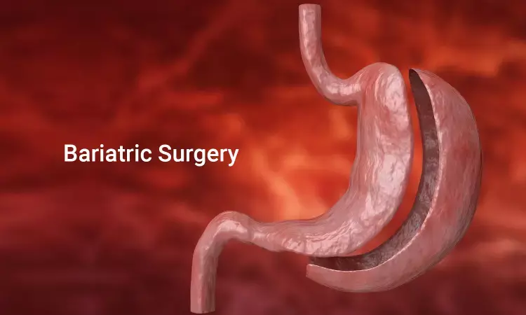 Bariatric surgery may increase life span in obese patients: NEJM