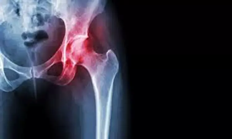 PPIs may increase the risk of fracture in children