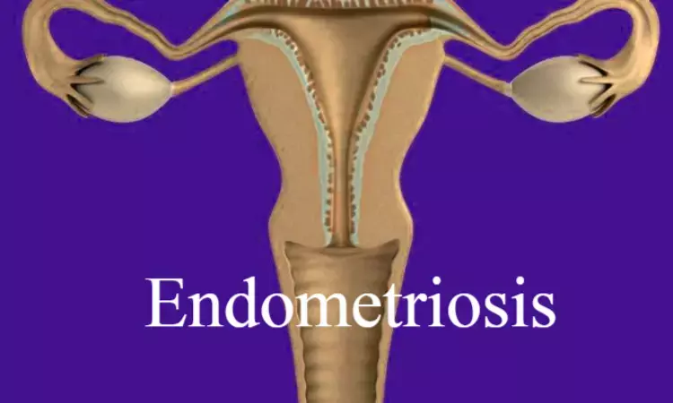 Endometriosis linked to increased risk of cancer and endometrial hyperplasia
