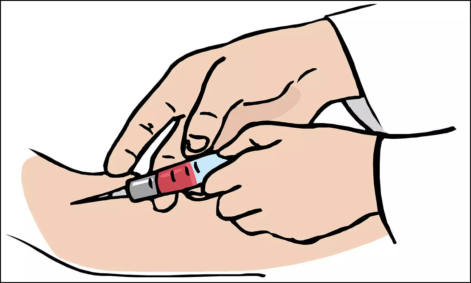 Novel blood test-A non-invasive diagnostic option to detect CAD