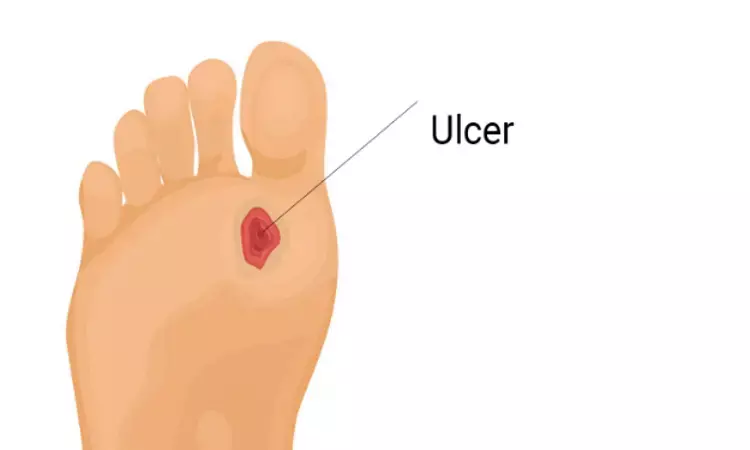 Case report of non-healing diabetic foot ulcers treated with Amniotic membrane