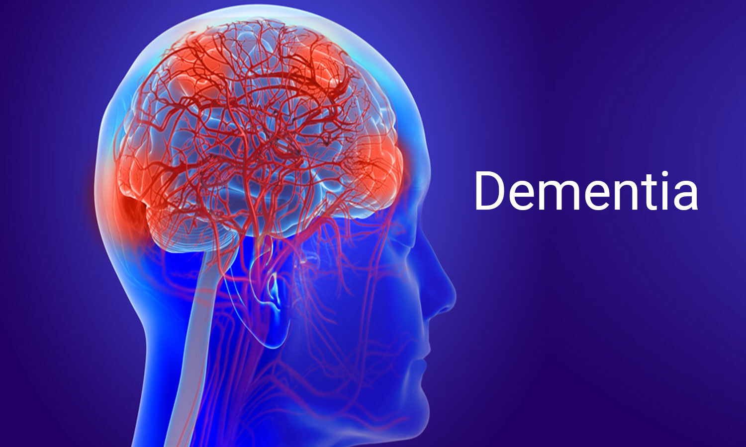 Is Dementia A Mental Health Condition