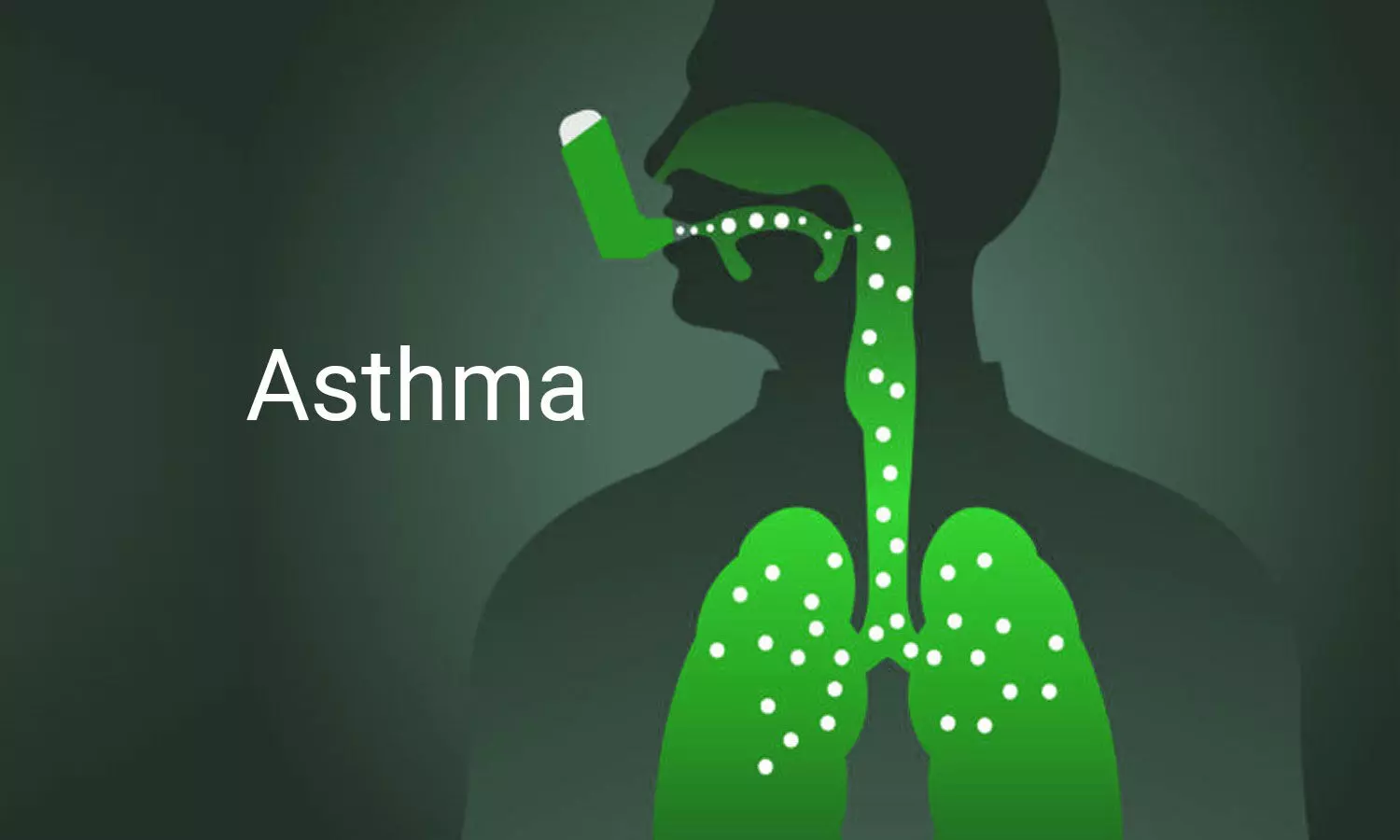 Iron overload may increase asthma severity, finds study