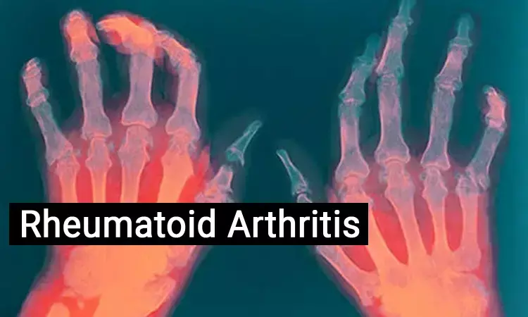 New breakthrough in treatment of rheumatoid arthritis