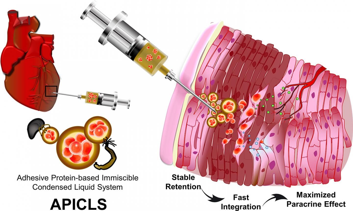 Liquid system