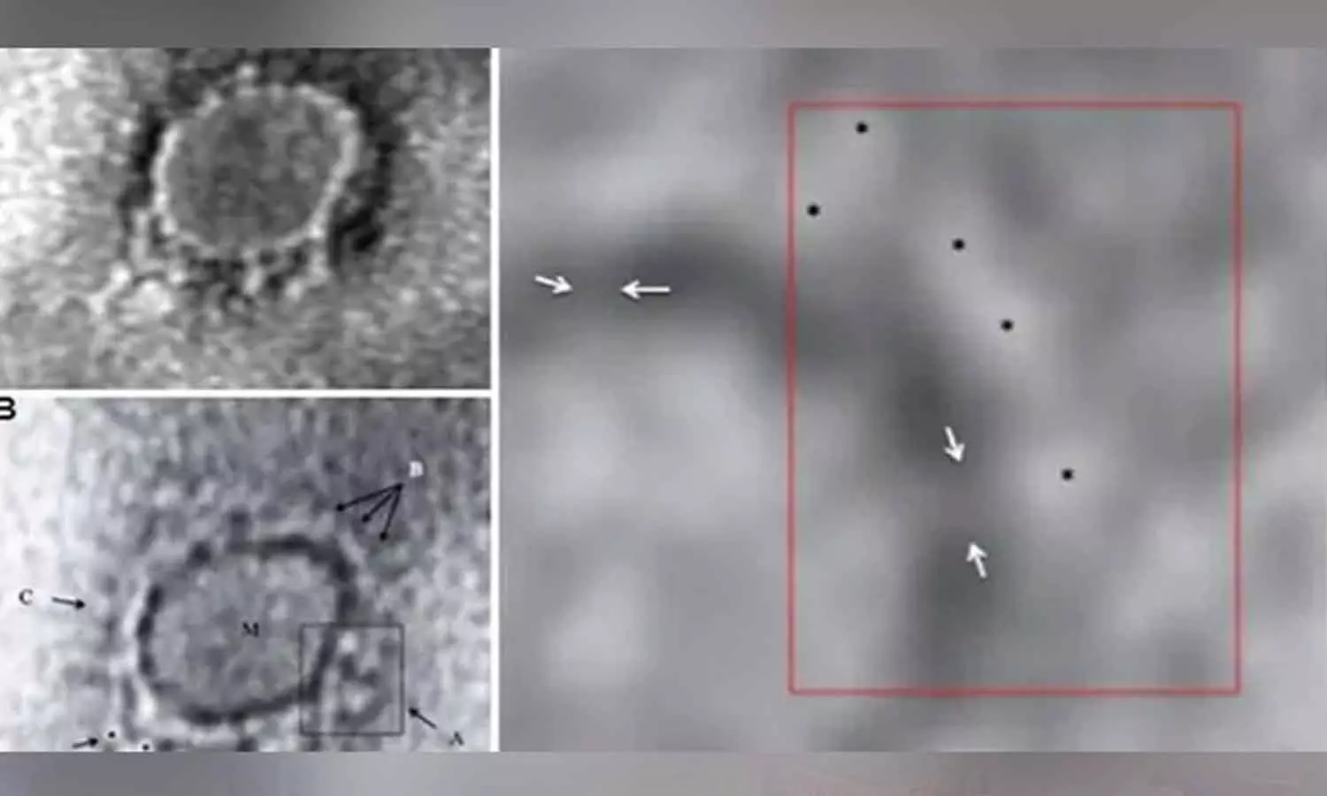 What Coronavirus looks under Electron Microscope: ICMR scientists release images