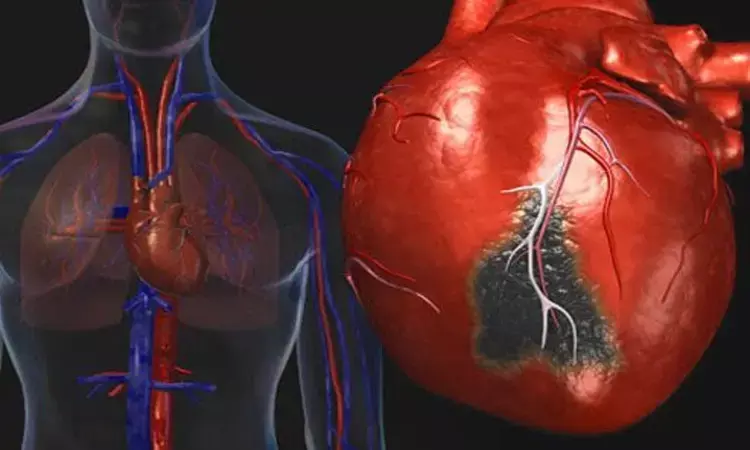 PCI or CABG more effective for stable patients with high-risk cardiac anatomy