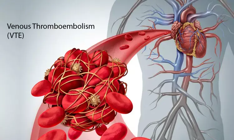 Obesity during adolescence increases VTE risk in adult life