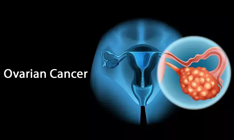 Chemotherapy more effective in relapsed ovarian cancer when coupled with cytoreductive surgery: NEJM