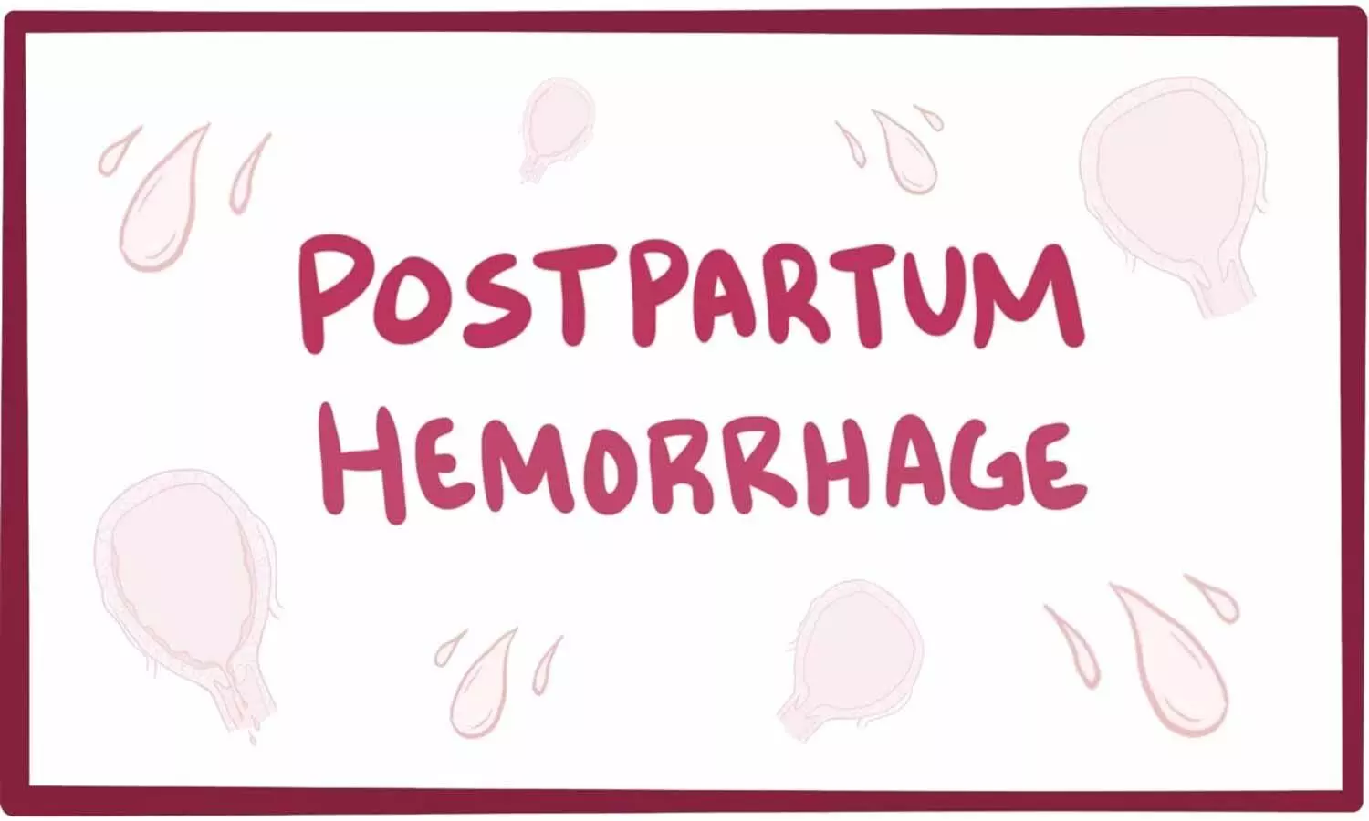 Researchers identify genetic connection to postpartum hemorrhage