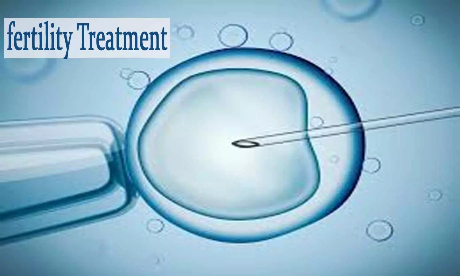 Experimental treatment offers hope of fertility for early menopausal women