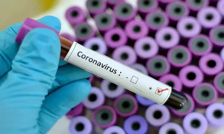US should lead global effort in developing, distributing COVID-19 vaccine: Congressmen