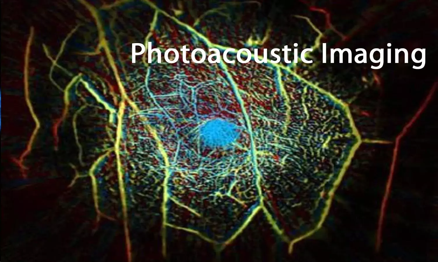 Photoacoustic imaging- New  imaging for safer heart procedures