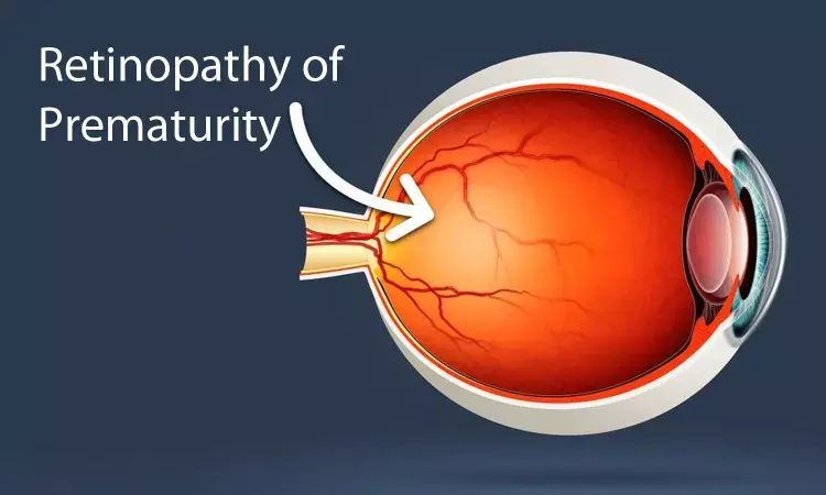 Intake of new supplement halves risk of retinopathy of prematurity, finds study