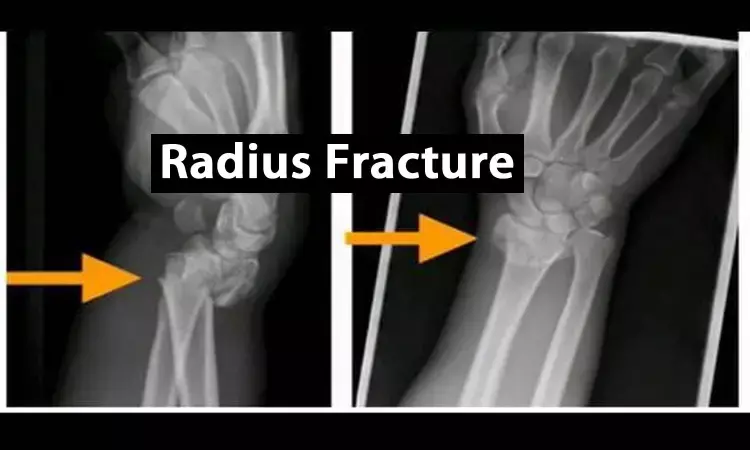 Operative treatment preferred choice for distal radius fractures: JAMA
