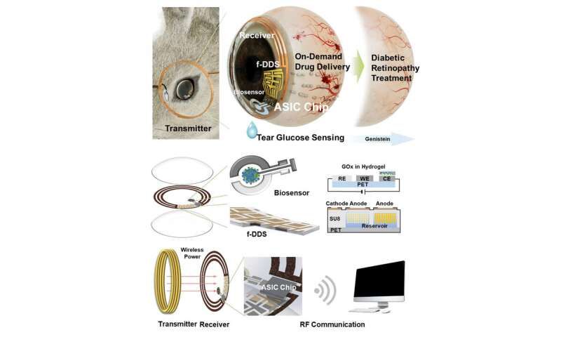 Smart contact lenses may diagnose diabetes and deliver drugs in retinopathy