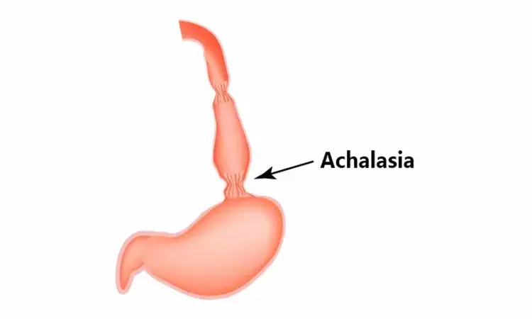 Case of Achalasia with cockscrew appearance radiologically
