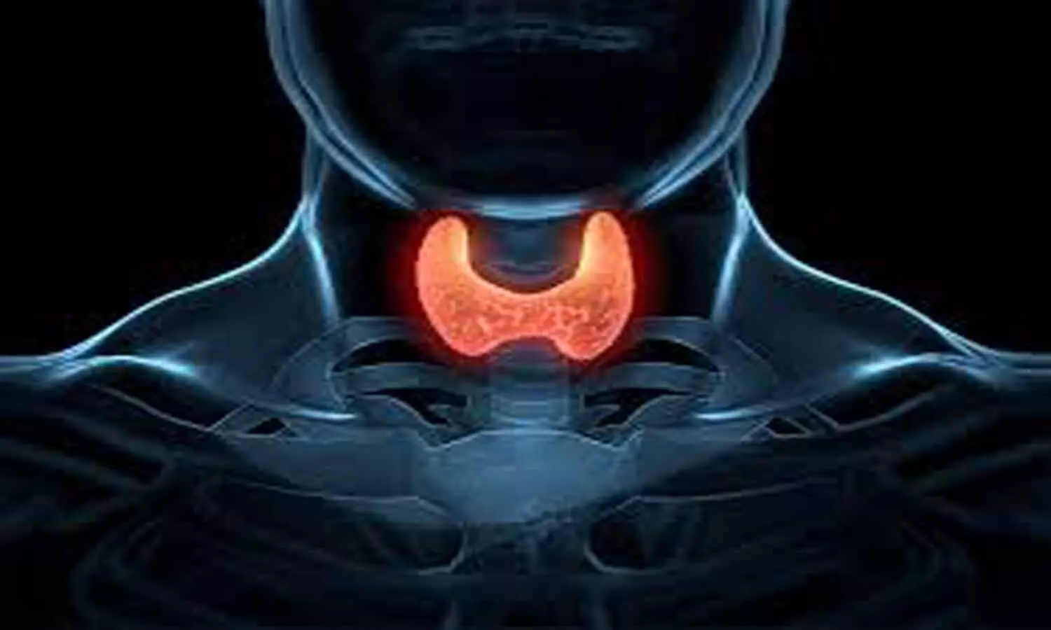 Aptinib shows increased overall survival in Patients with Thyroid Cancer: JAMA